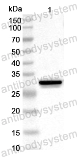 Anti-CA6 VP3/P1C Polyclonal Antibody