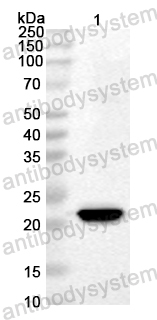 Anti-CA6 P3C/Protease 3C Polyclonal Antibody