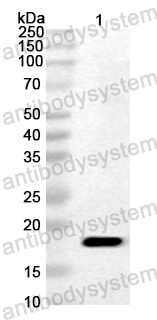 Anti-CA6 P2A/Protease 2A Polyclonal Antibody