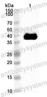 Anti-CA16 P2C/Protein 2C Polyclonal Antibody