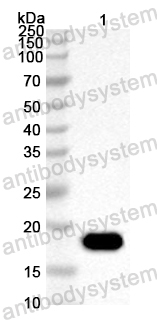 Anti-CA16 P2A/Protease 2A Polyclonal Antibody
