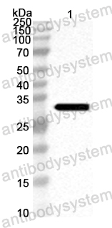 Anti-CA16 VP2/P1B Polyclonal Antibody