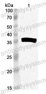 Anti-CA16 VP4/P1A Polyclonal Antibody