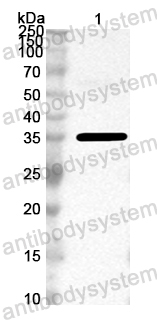 Anti-CA16 VP1/P1D Polyclonal Antibody