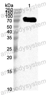 Anti-HPV B19 NS1/Non-structural protein 1 Polyclonal Antibody
