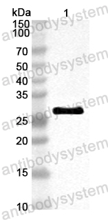 Anti-HPV B19 VP2/Coat protein VP2 Polyclonal Antibody
