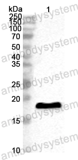 Anti-HPV B19 VP1/Coat protein VP1 Polyclonal Antibody