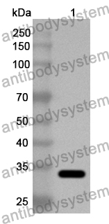 Anti-EV71 VP1/Capsid protein VP1 Polyclonal Antibody