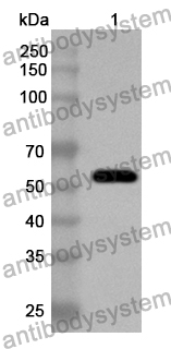 Anti-EV71 VP3/Capsid protein VP3 Polyclonal Antibody