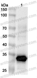 Anti-Zaire ebolavirus NP/Nucleoprotein Polyclonal Antibody