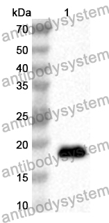 Anti-Rubella virus/RUBV Polyprotein Polyclonal Antibody