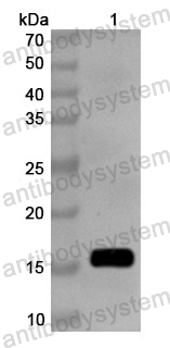 Anti-MARV VP35/Marburg VP35 Polyclonal Antibody
