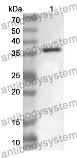 Anti-MARV VP40/Marburg VP40 Polyclonal Antibody