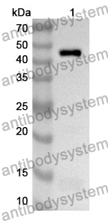 Anti-HCoV-229E NP/Nucleoprotein Polyclonal Antibody