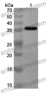 Anti-Poliovirus type 1 VP0/Capsid protein VP0 Polyclonal Antibody