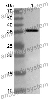 Anti-Poliovirus type 1 VP1/Capsid protein VP1 Polyclonal Antibody