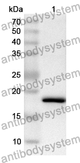 Anti-HMPV SH/Small hydrophobic protein Polyclonal Antibody