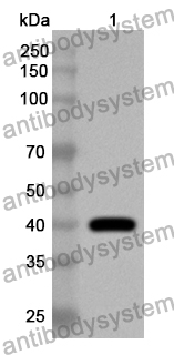 Anti-HMPV Matrix protein/M Polyclonal Antibody