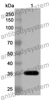 Anti-HMPV Phosphoprotein/P Polyclonal Antibody