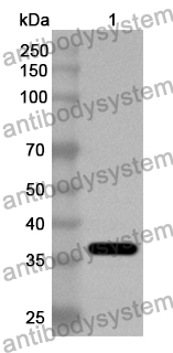 Anti-HMPV M2/Protein M2-2 Polyclonal Antibody