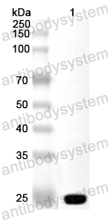 Anti-RABV M/Matrix protein Polyclonal Antibody