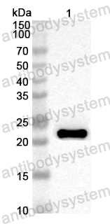 Anti-EV68P3C/Protease 3C Polyclonal Antibody