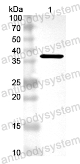Anti-EV68VP1/P1D Polyclonal Antibody