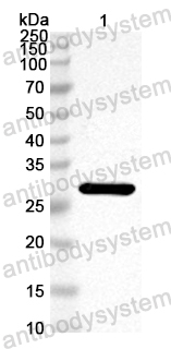 Anti-EV68VP3/P1C Polyclonal Antibody