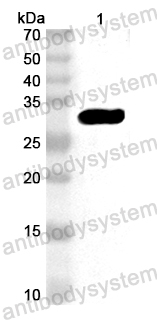 Anti-EV68VP2/P1B Polyclonal Antibody