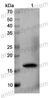 Anti-Tupaia chinensis CD8A Polyclonal Antibody