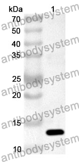 Anti-SO1A1 Polyclonal Antibody