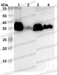 Anti-Penaeus monodon TM1/Tropomyosin Polyclonal Antibody