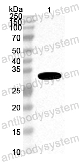 Anti-Greasyback shrimp Met e 1/Tropomyosin Polyclonal Antibody