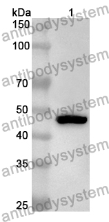 Anti-Clostridioides difficile Toxin B/tcdB Polyclonal Antibody