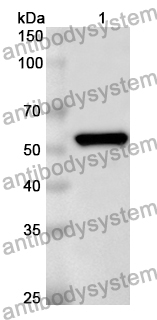 Anti-Clostridium perfringens pfo/Perfringolysin O/Theta-toxin Polyclonal Antibody