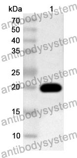 Anti-Pseudomonas aeruginosa PcrV Polyclonal Antibody