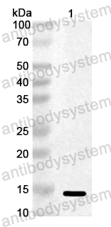 Anti-Vibrio cholerae serotype O1 ctxB/Cholera Toxin Subunit B Polyclonal Antibody