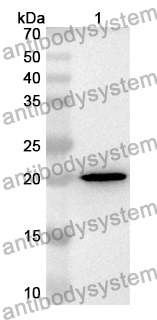 Anti-Treponema pallidum TPF1/Antigen 4D Polyclonal Antibody