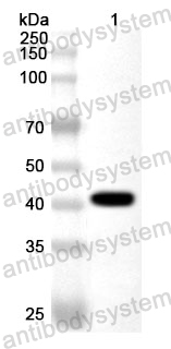 Anti-Treponema pallidum TPP17 Polyclonal Antibody