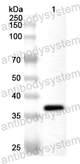 Anti-Treponema pallidum tmpA Polyclonal Antibody