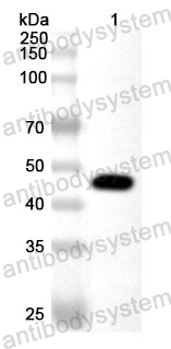 Anti-Treponema pallidum TPP47 Polyclonal Antibody