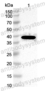 Anti-Malassezia furfur Mal f 1/Allergen Pit o 1/Mala s 1 Polyclonal Antibody