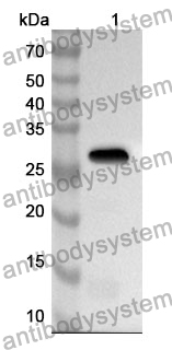 Anti-Streptococcus pyogenes speB/Streptopain Polyclonal Antibody