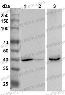 Anti-Clostridium perfringens nanH/Sialidase Polyclonal Antibody