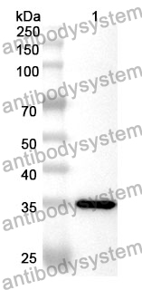 Anti-Staphylococcus aureus LukS-PV Polyclonal Antibody