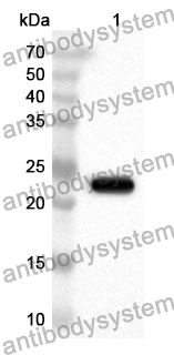 Anti-Escherichia coli eltB/ltpB Polyclonal Antibody