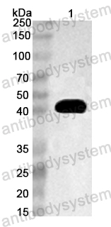 Anti-Clostridium perfringens CPE Polyclonal Antibody