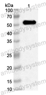 Anti-Streptococcus pneumoniae Pneumolysin/ply Polyclonal Antibody