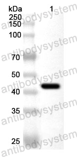 Anti-Treponema pallidum FlaB3 Polyclonal Antibody