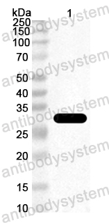 Anti-Staphylococcus aureus entA/SEA Polyclonal Antibody